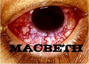 Macbeth_Eye_UPCOMING